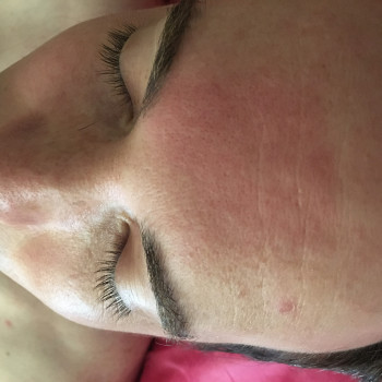 До очищения кожи и массажа лица