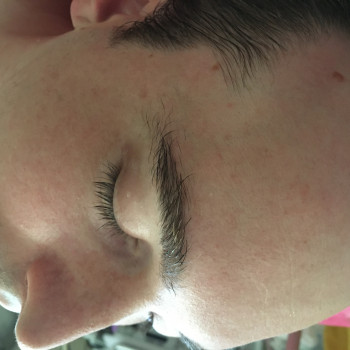 После массажа лица и после золотой маски