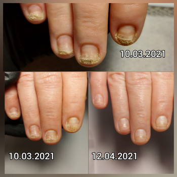 Ольга Подолог, Бровари Фото - 7