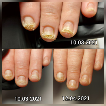 Ольга Подолог, Бровари Фото - 8