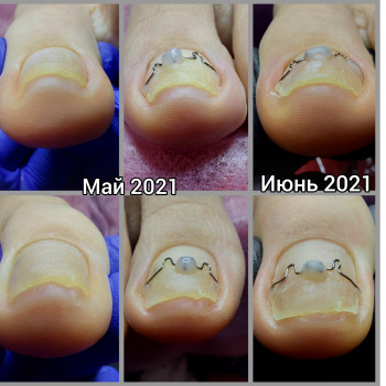 Ольга Подолог, Бровари Фото - 9