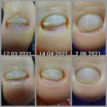 Ольга Подолог, Бровари Фото - 11