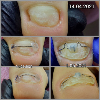 Ольга Подолог, Бровари Фото - 12