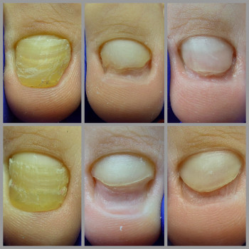 Ольга Подолог, Бровари Фото - 14