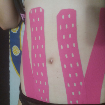 Лифодренаж живота