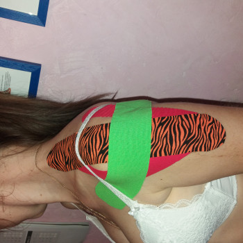 фиксация плечевого сустава