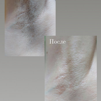 Диана Тесленко, Біла Церква Фото - 7