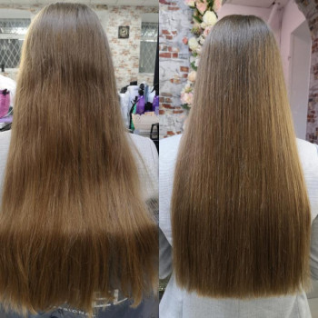 Фото з портфоліо майстра Анна Якименко (трихолог, Дніпро)