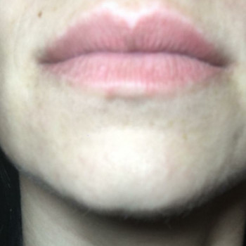 Ксения Островская, Київ Фото - 6