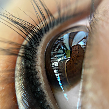 Межресничка