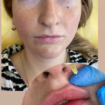 Кристина Бондарчук, Одеса Фото - 6