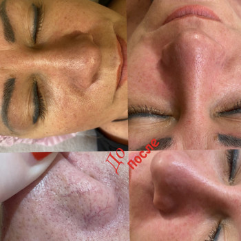 Кристина Бондарчук, Одеса Фото - 7