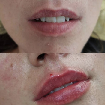 Кристина Бондарчук, Одеса Фото - 9