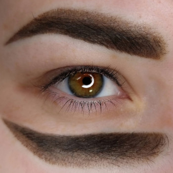 Межресничка