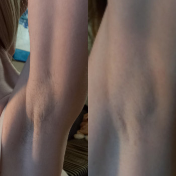 Катерина Малашкевич, Одеса Фото - 5