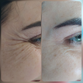 Юлия Злочевская, Белая Церковь Фото - 20