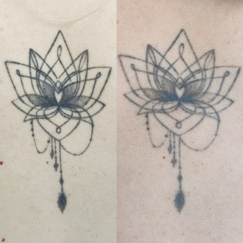 1 проц удаления. Осветление тату на спине.