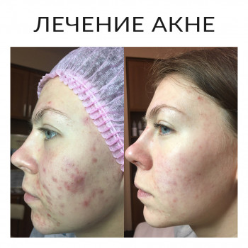 Наталия Черниго, Київ Фото - 19