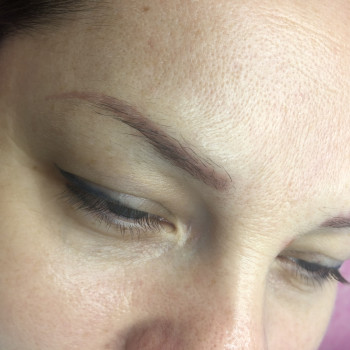 Удалениедо старого татуажа