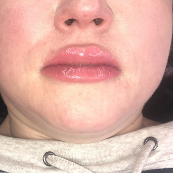 Ірина Сидорова, Житомир Фото - 17