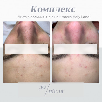 TK Laser, Ровно Фото - 2