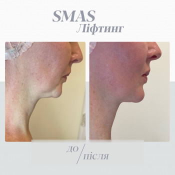 TK Laser, Ровно Фото - 5