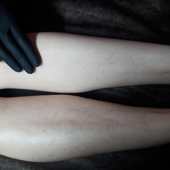 Наталья Ничкалюк, Киев Фото - 8