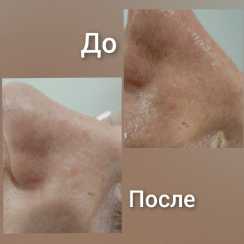 Кристина Лопатина, Одесса Фото - 6