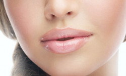 Увеличение объёма губ инъекциями гиалуроновой кислоты Салон краси Persona Style Academy Beauty Маріуполь