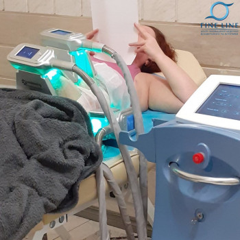 кріоліполіз 4 насадкі