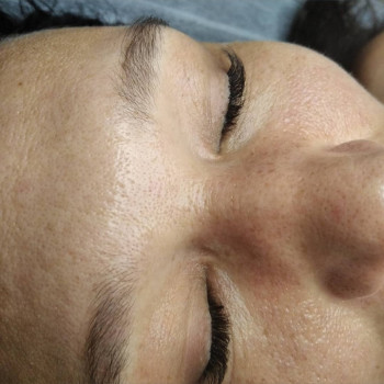 Микс изгиба С и L+