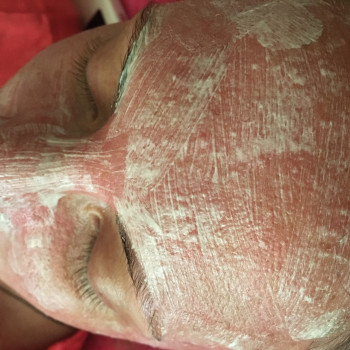 В процессе чистки