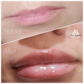 Техника"Плоский бант"