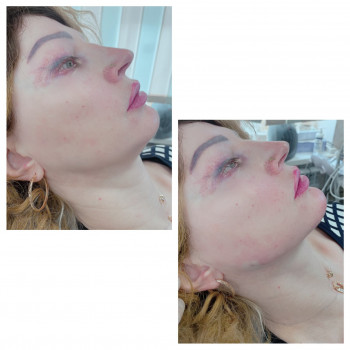 Светлана Цибульская, Полтава Фото - 12