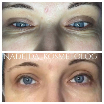 Массаж лица
                    Косметолог-эстетист Надежда Киев