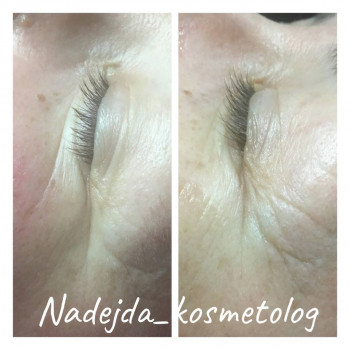 Массаж лица
                    Косметолог-эстетист Надежда Киев