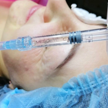 Біорепарація обличчя шиї декольте
                    Лікар-косметолог Юлия Харків