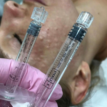 Біорепарація обличчя шиї декольте
                    Лікар-косметолог Юлия Харків