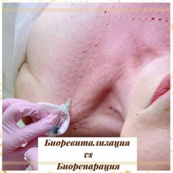 Біорепарація обличчя шиї декольте
                    Лікар-косметолог Юлия Харків