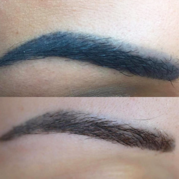 Удаление татуажа лазером
                    Майстер перманентного макіяжу Ксения Кобылянская Київ