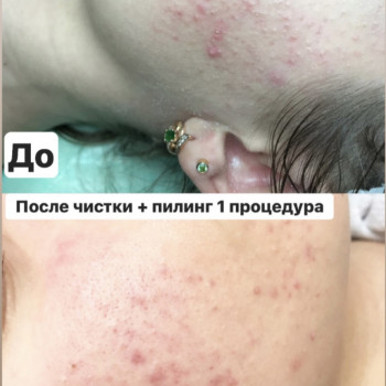 Наталія Бутенко, Полтава Фото - 8