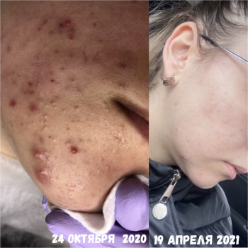 Анна Бондаренко, Киев Фото - 5