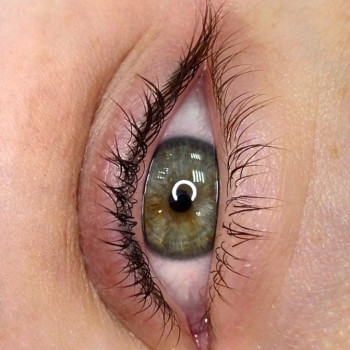 Зажившая межресничка после 1 процедуры