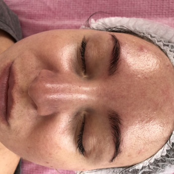 Комбинированная чистка: ультразвуком + механическая. Поверхн