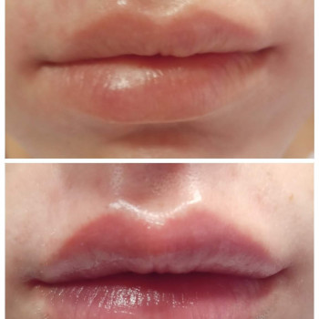 Маріанн Євлах, Київ Фото - 4