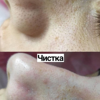 Тетяна Кара, Одеса Фото - 22