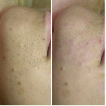 Тетяна Кара, Одеса Фото - 25