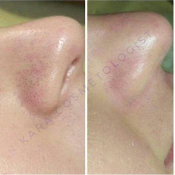 Тетяна Кара, Одеса Фото - 26