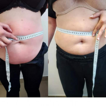 9-ть процедур