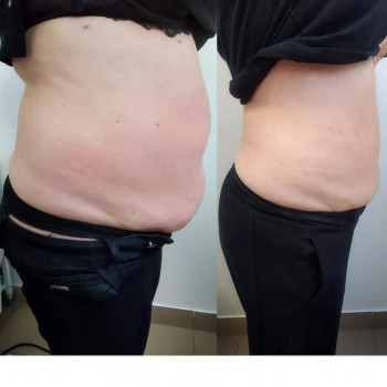 9-ть процедур